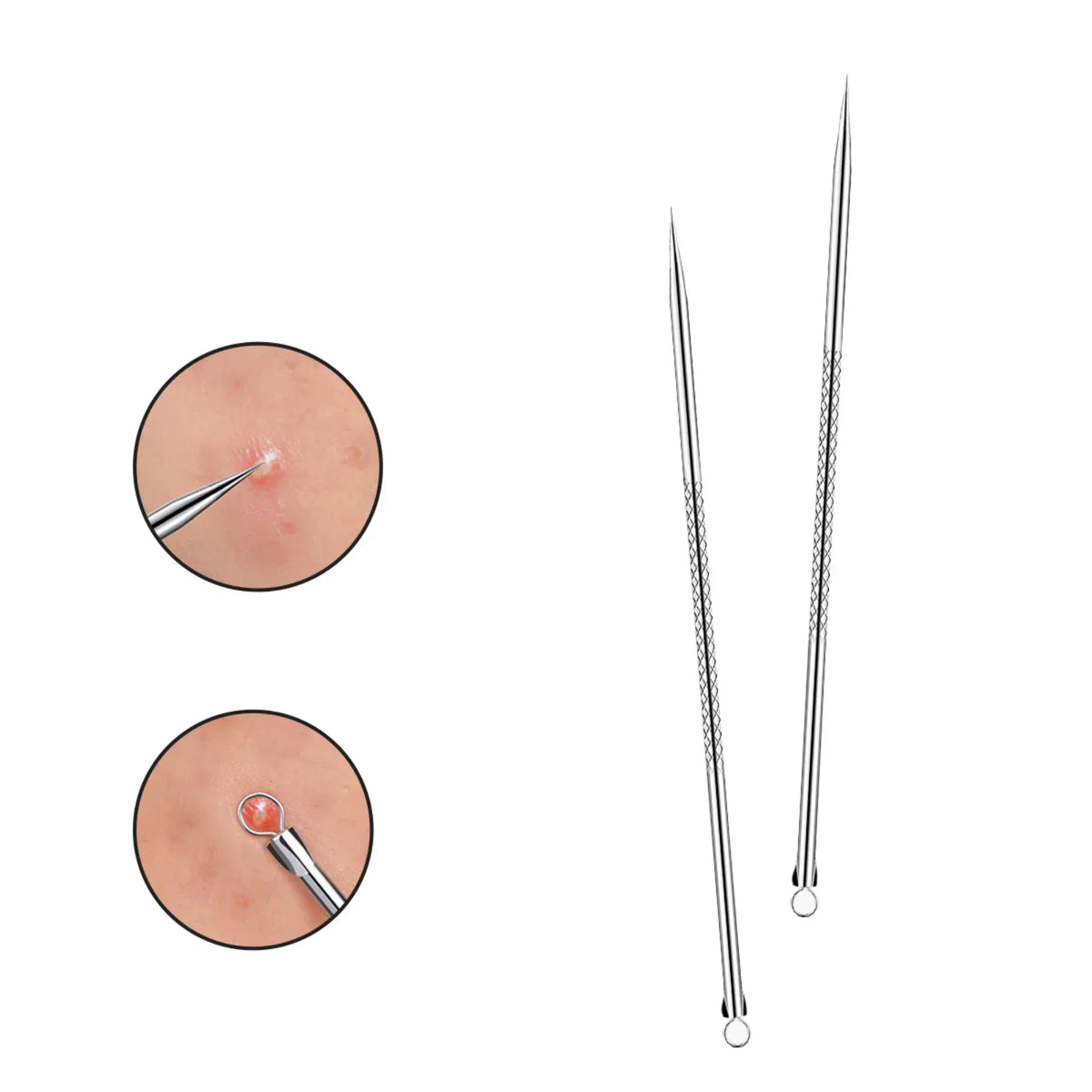 Acne Needle for Women Image