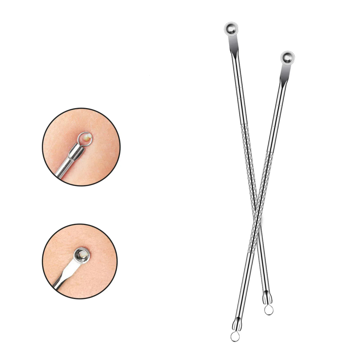 Acne Needle for Women Image